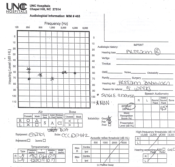 Audiogram-2008-10-17.jpg