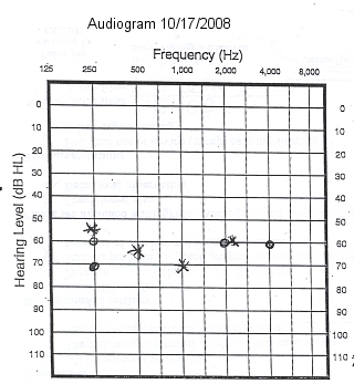 Audiogram-GraphOnly-2008-10-17.jpg