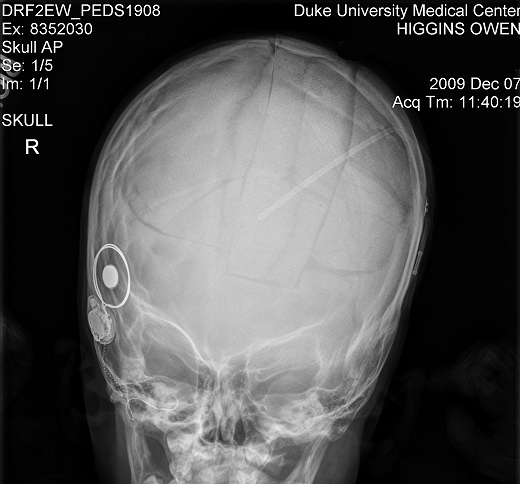 shuntseries-front.jpg
