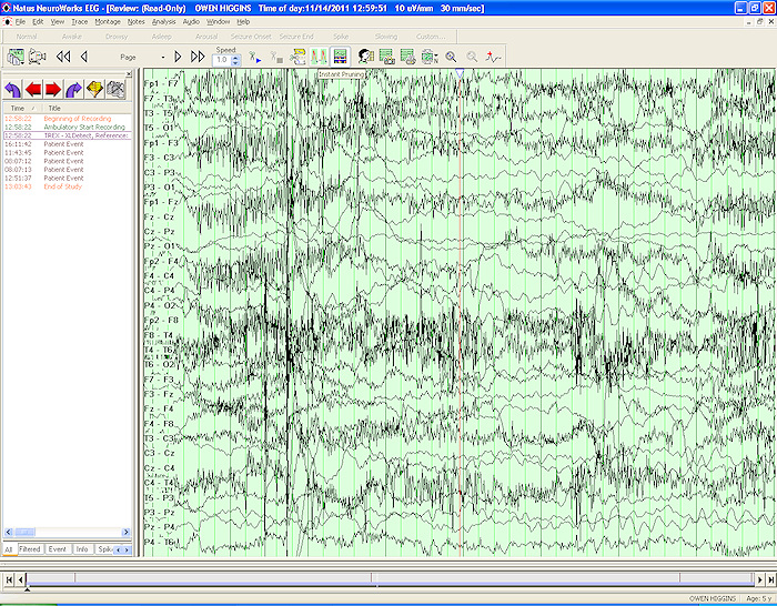 eeg-scribbles.jpg
